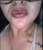 Customer photo